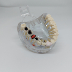 Transparent Sygdomsmodel